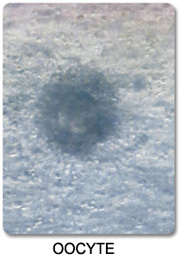 Mature Metaphase II Oocyte