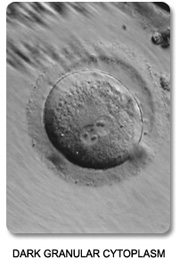 Dark Granular Cytoplasm