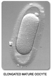 Elongated Oocyte