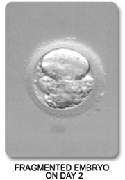 Fragmented Day 2 Embryo