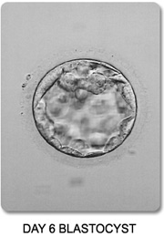 Expanded Blastocyst