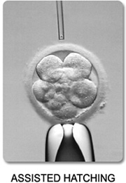 Assisted Hatching Embryo